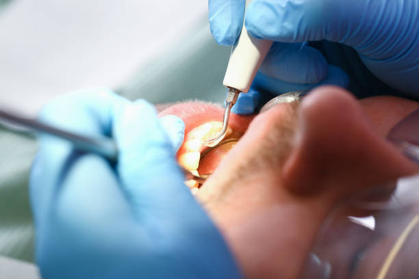 Best Emergency Dental Care for Abscessed Tooth in Saks, AL